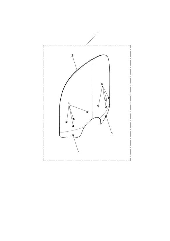 Screen Moulding Kit